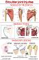 Shoulder Joint Injuries - 50 x 70 cm - 